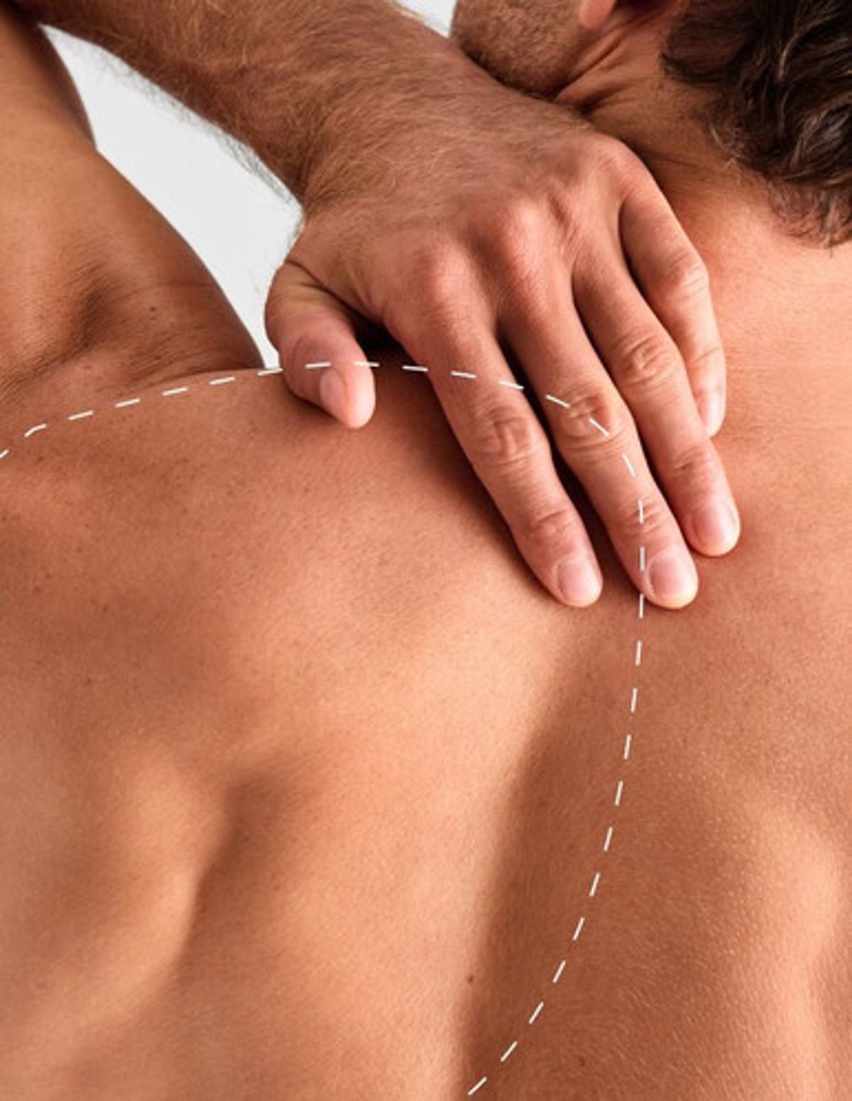 Back laser hair removal