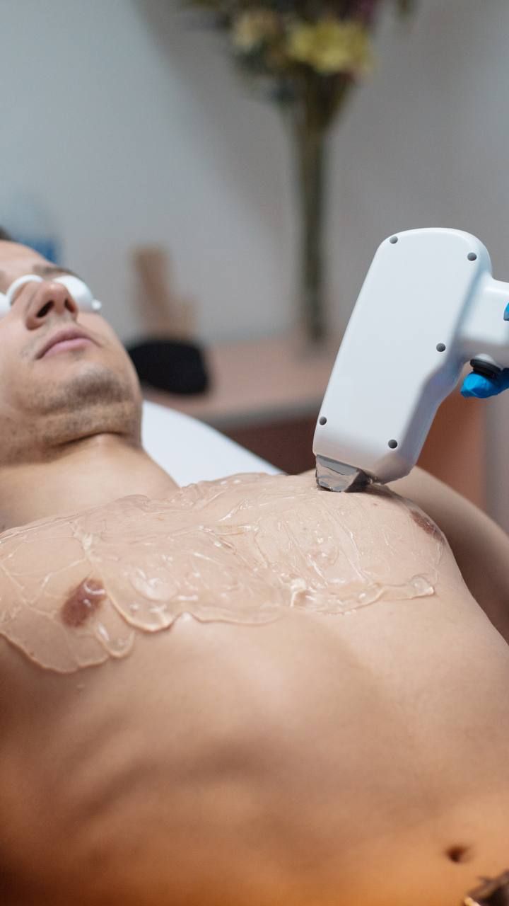 Chest laser hair removal