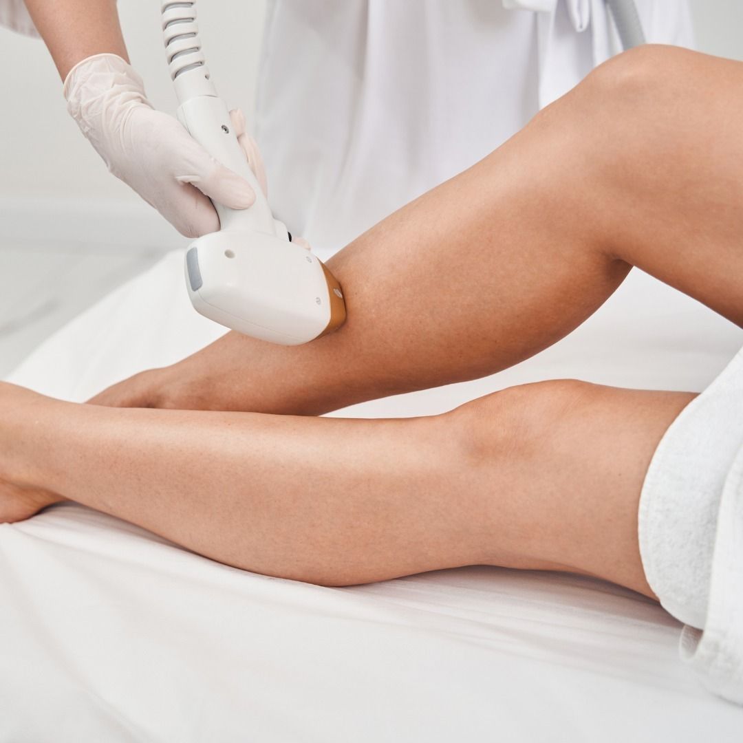 Legs laser hair removal